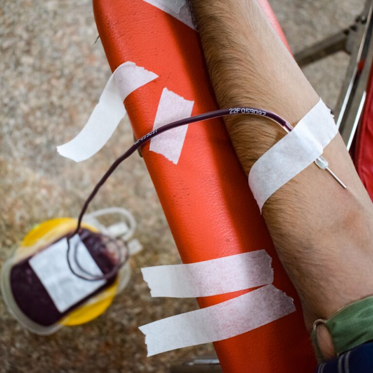 Blood being collected from a donor's arm into a medical blood bag