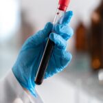 Gloved laboratory hand holding a blood sample tube for multi-cancer detection testing