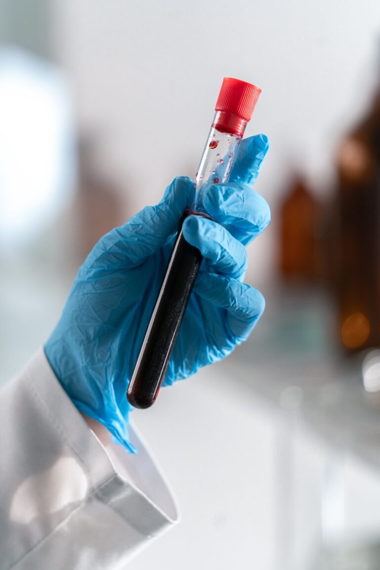 Gloved laboratory hand holding a blood sample tube for multi-cancer detection testing